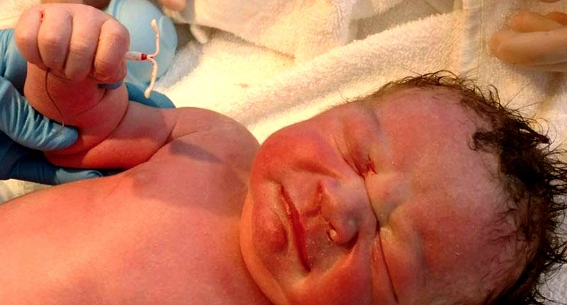 Baby Born Holding Implant That Was Supposed To Stop Mum Getting Pregnant dexter