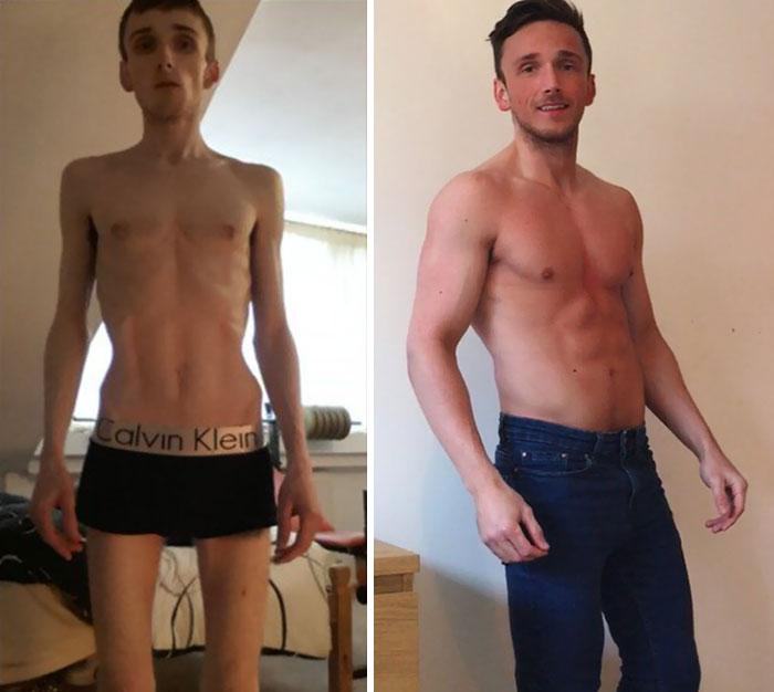Danny Walsh Slipped Into The Grip Of Anorexia After Becoming Obsessive Over Football, Training To Be The Best Player He Could Be But Within Four Months He Managed To Beat The Illness And Gain Weight