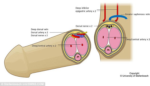 As part of the procedure, doctors transplanted a new penis, donated by an unknown man. The pictures show the veins and blood vessels they connected