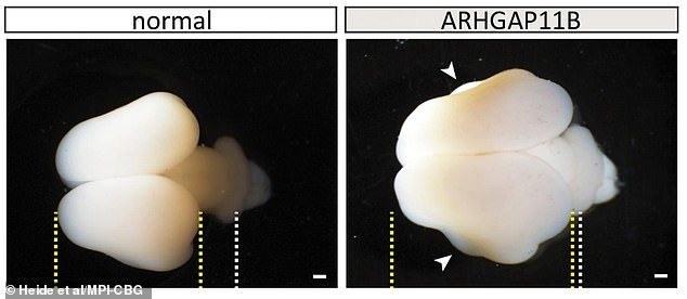 扩增脑皮质基因ARHGAP11B